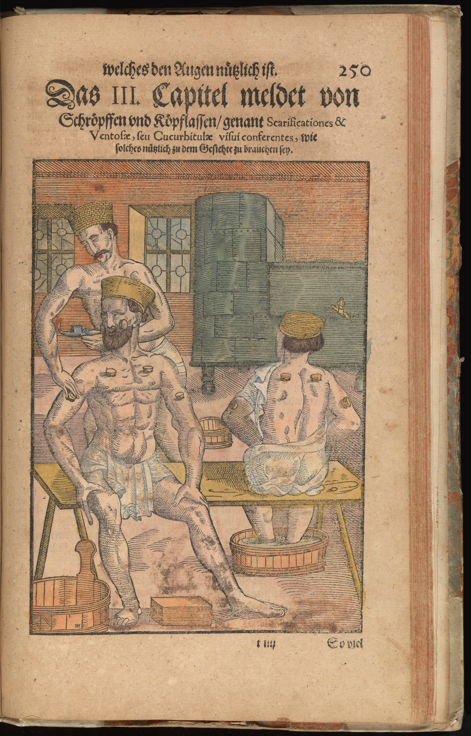 Read more about the article What is Cupping?