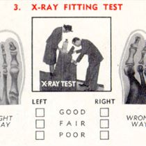 Read more about the article The Rise and Fall of Shoe Fitting Fluoroscopes