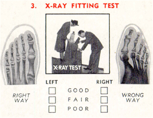 Detail from shoecard possibly distributed by salesmen to their clients, showing both X-ray images of feet in shoes and a fluoroscope in use.